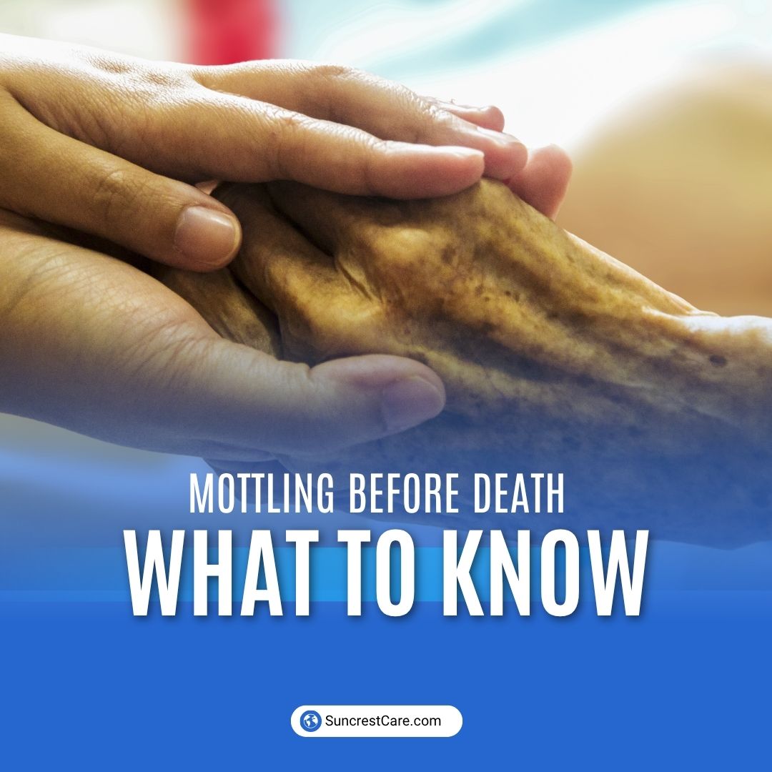 Mottling before death: what families may notice near the end of life